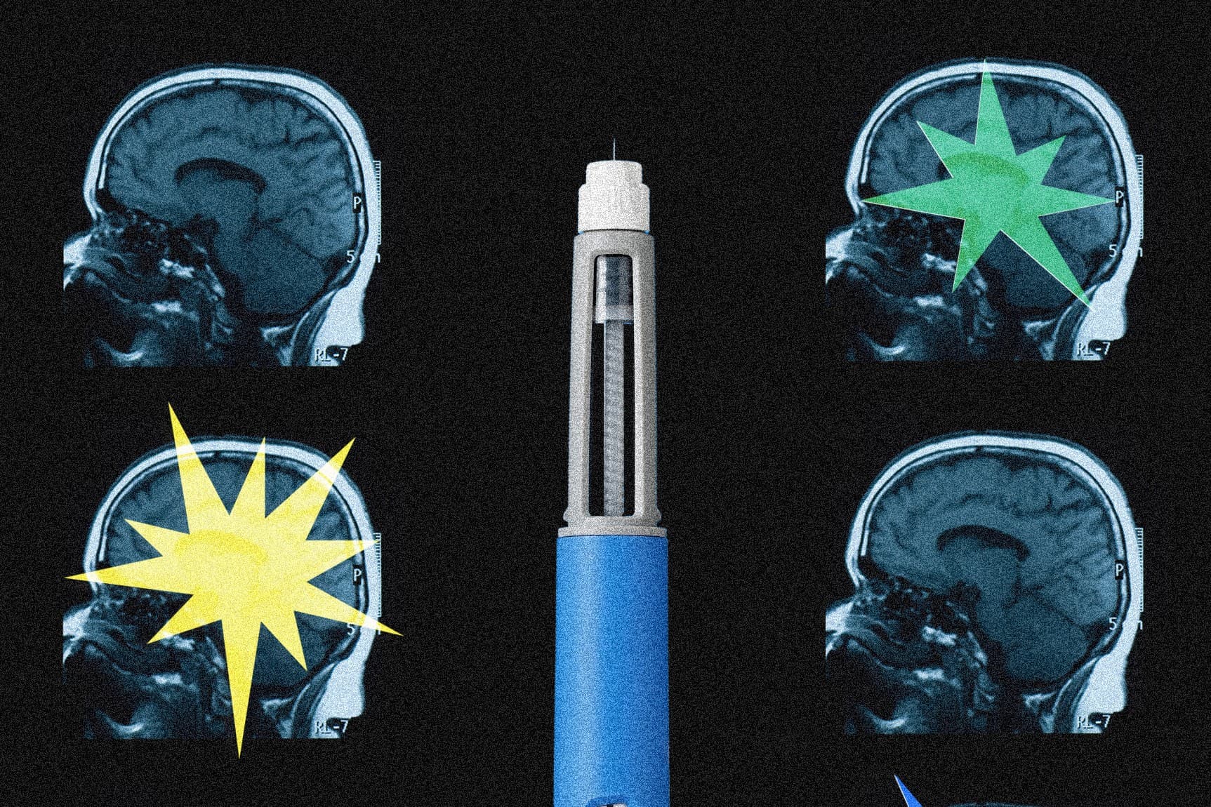 Image from the article by ClinicalTrials.gov: A GLP-1 medicine is being tested against methamphetamine addiction