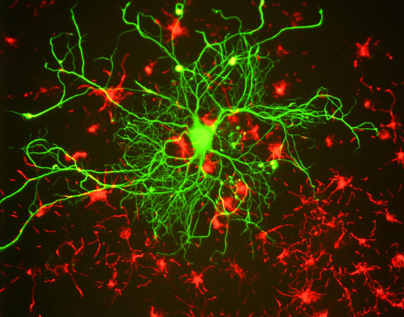 Imagen de microscopía fluorescente de una neurona en cultivo de tejidos.