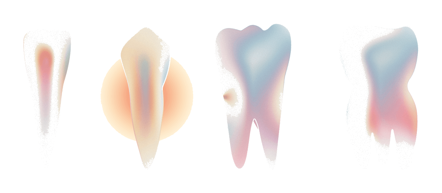 Translucent teeth with warm and cool dental stress signals.
