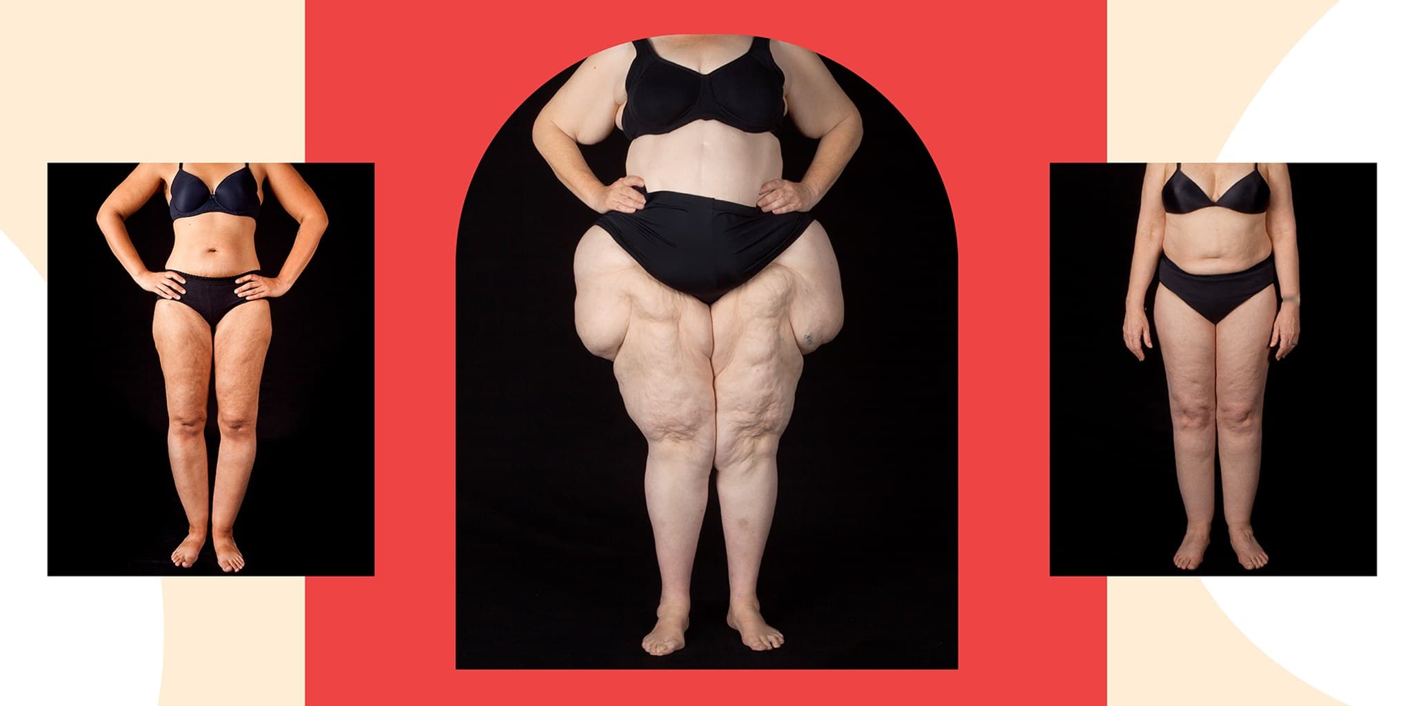 Editorial lead image accompanying Women's Health coverage.